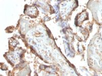 FFPE human placenta sections stained with 100 ul anti-Human Chorionic Gonadotropin (clone HCGab/52) at 1:50. HIER epitope retrieval prior to staining was performed in 10mM Citrate, pH 6.0.